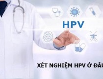 Xét nghiệm HPV là gì và ở đâu tốt tại Hà Nội